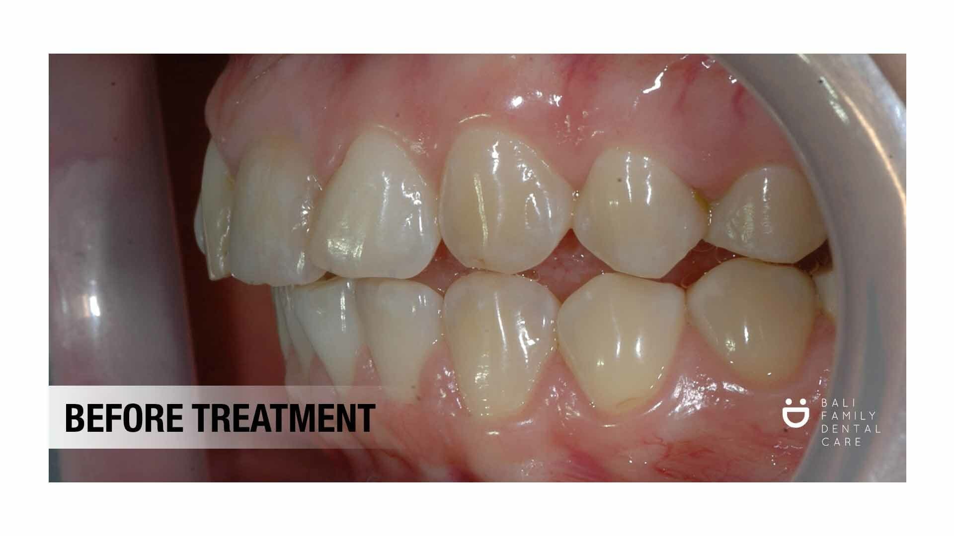 Bali Family Dental Care