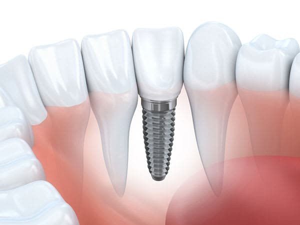 Dentalaesthetics Dr. Muhlis Akarsu