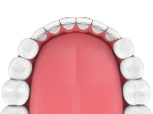 Emergency Dental of Denver