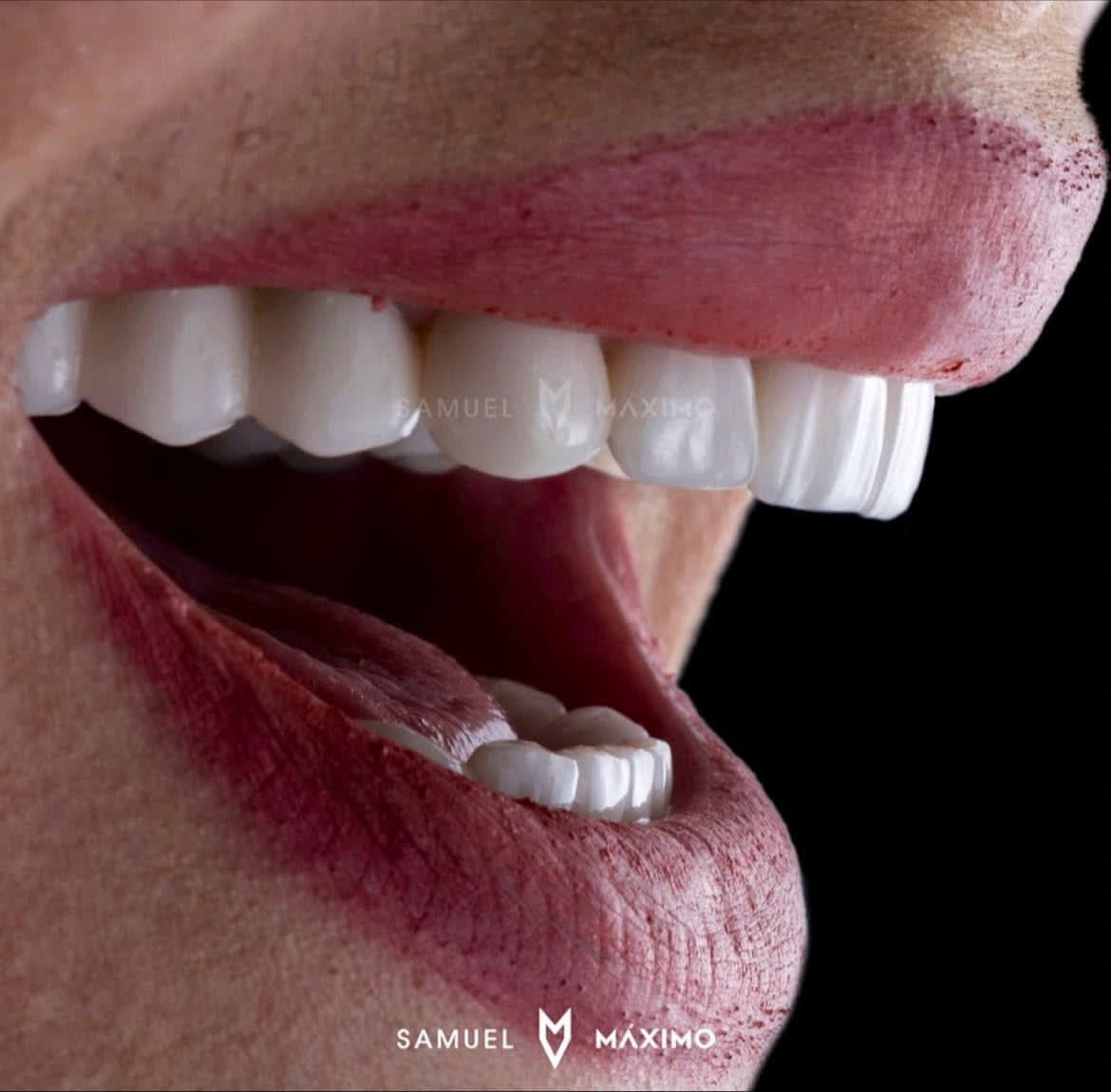 Endodoncia